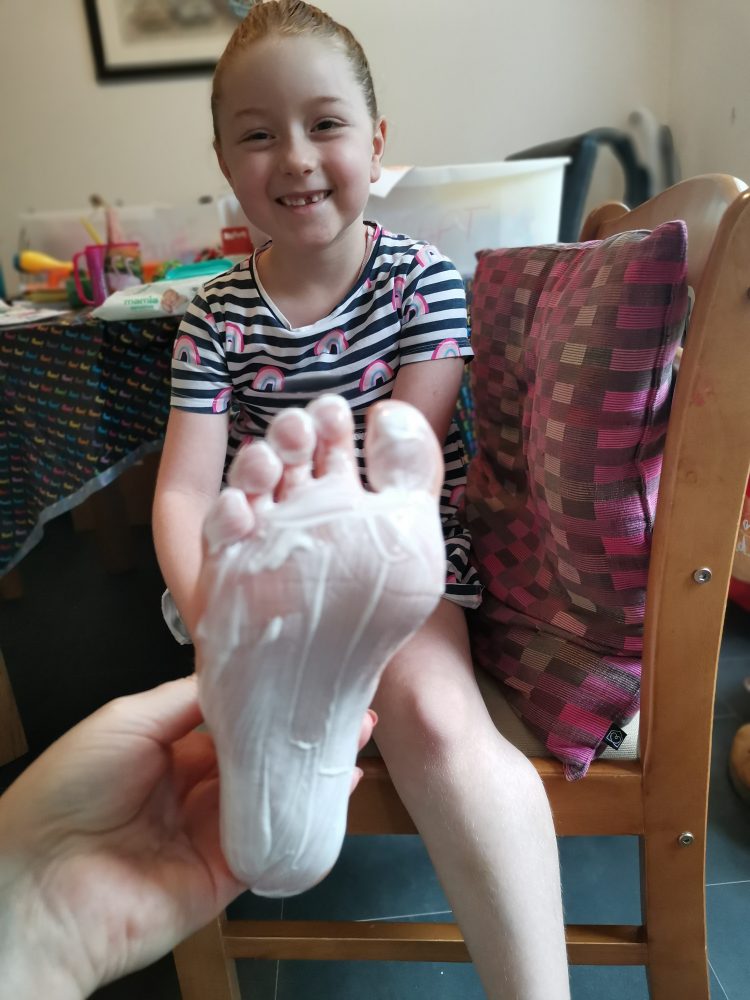 A photo of a girl showing the bottom of her foot.  her foot is painted white